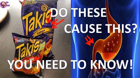 Do takis give you cancer - Feb 20, 2017 ... Hot Cheetos and Takis could land you in the emergency room. WXYZ-TV ... Pastry Chef Attempts to Make Gourmet Takis | Gourmet Makes | Bon Appétit.